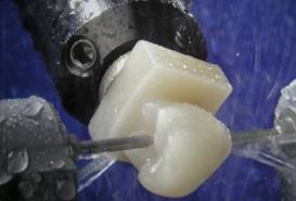 Je estetika nhrady zhotoven robotem CEREC stejn jako u nhrady zhotoven v zubn laboratoi?