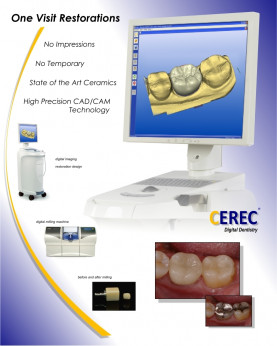 CEREC: Jak jsou nejvt vhody pro pacienta?